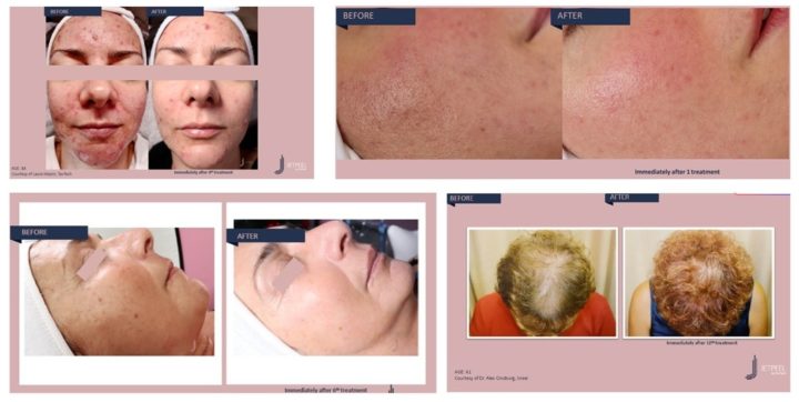 before and after images