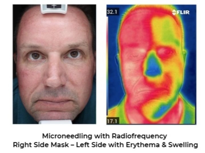 Heat before and after image