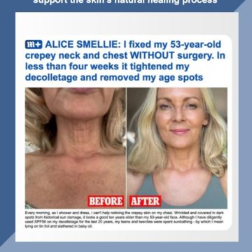 Post-procedure care - Daily Mail