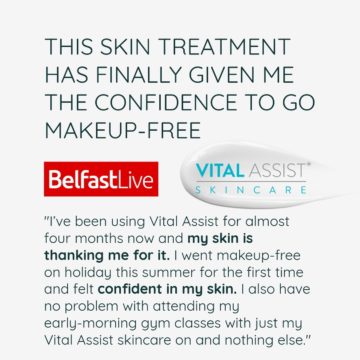 Vital Assist Skincare featured in Belfast Live