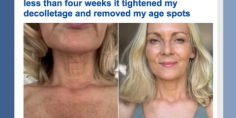 Post-procedure care - Daily Mail